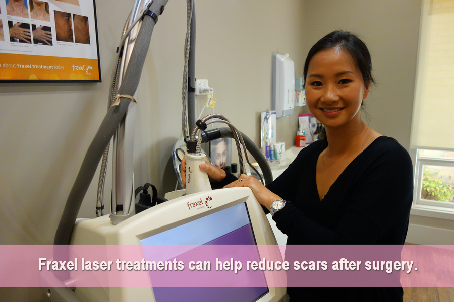 TGA approved injectables Fraxel Laser scar minimisation