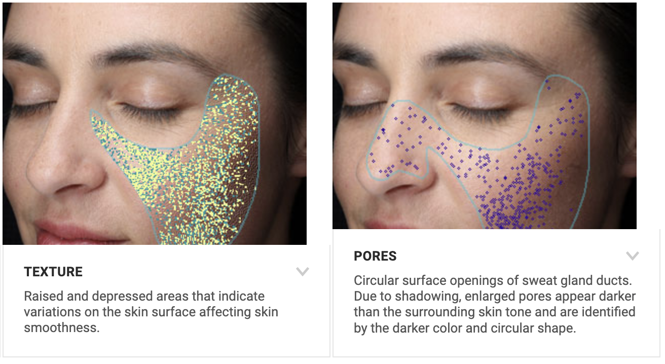 visia skin analysis melbourne clinic 1